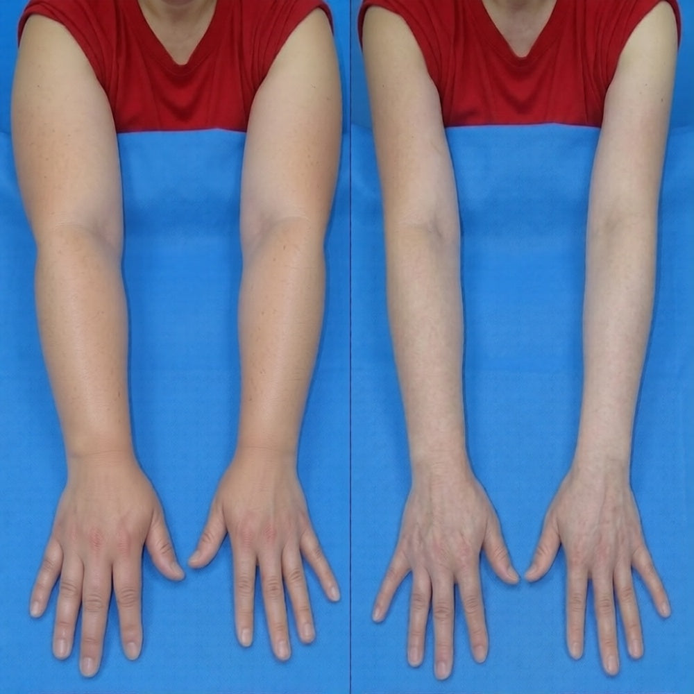 Lymphatic Drainage Drops